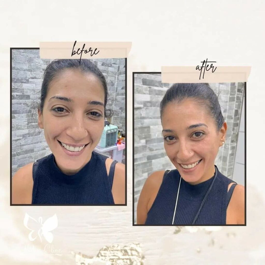 جلسات تنظيف البشرة في مركز نضارة في الغردقة